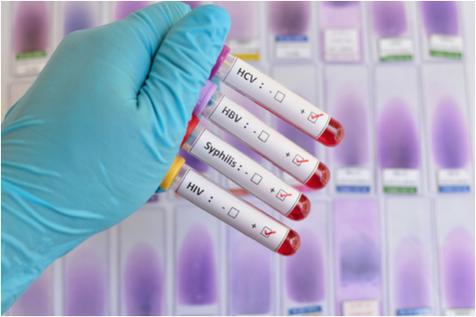 Muestras de laboratorio para el análisis de ETS.