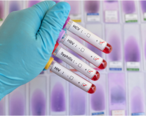 Muestras de laboratorio para el análisis de ETS.